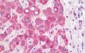 HADHB Antibody